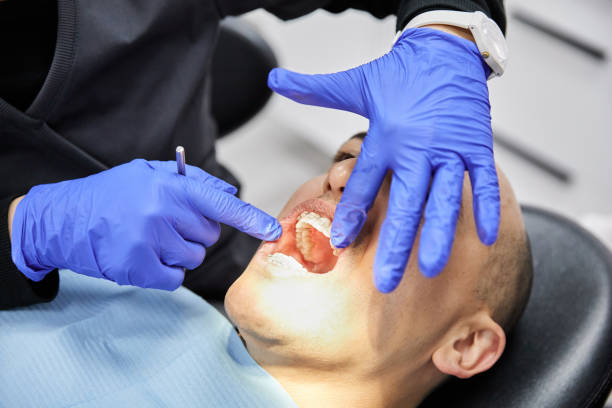 Best Broken Tooth Emergency  in Centerville, OH