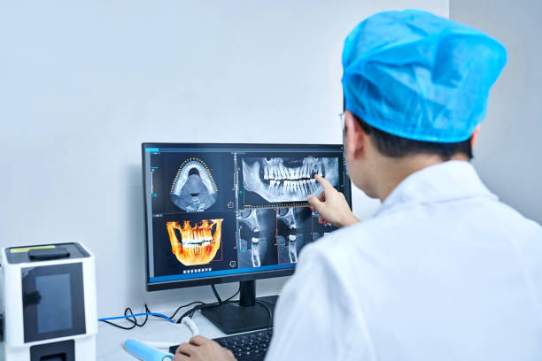 Best Chipped Tooth Repair Near Me  in Centerville, OH